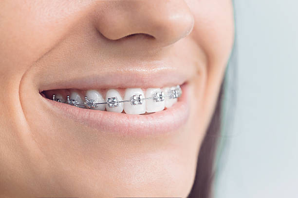 Best Veneers and Lumineers  in Edison, GA